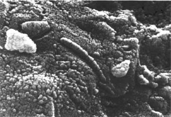 Tyčinkovité útvary podobné mikrofosíliím. Kliknutím získáte obrázek s větším rozlišením.